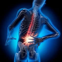 Back Pain - Image 1