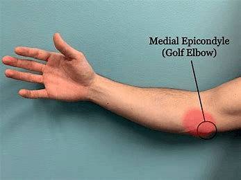 Elbow Pain - Image 2