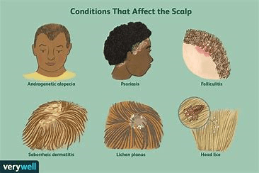 Scalp Scaling - Image 1