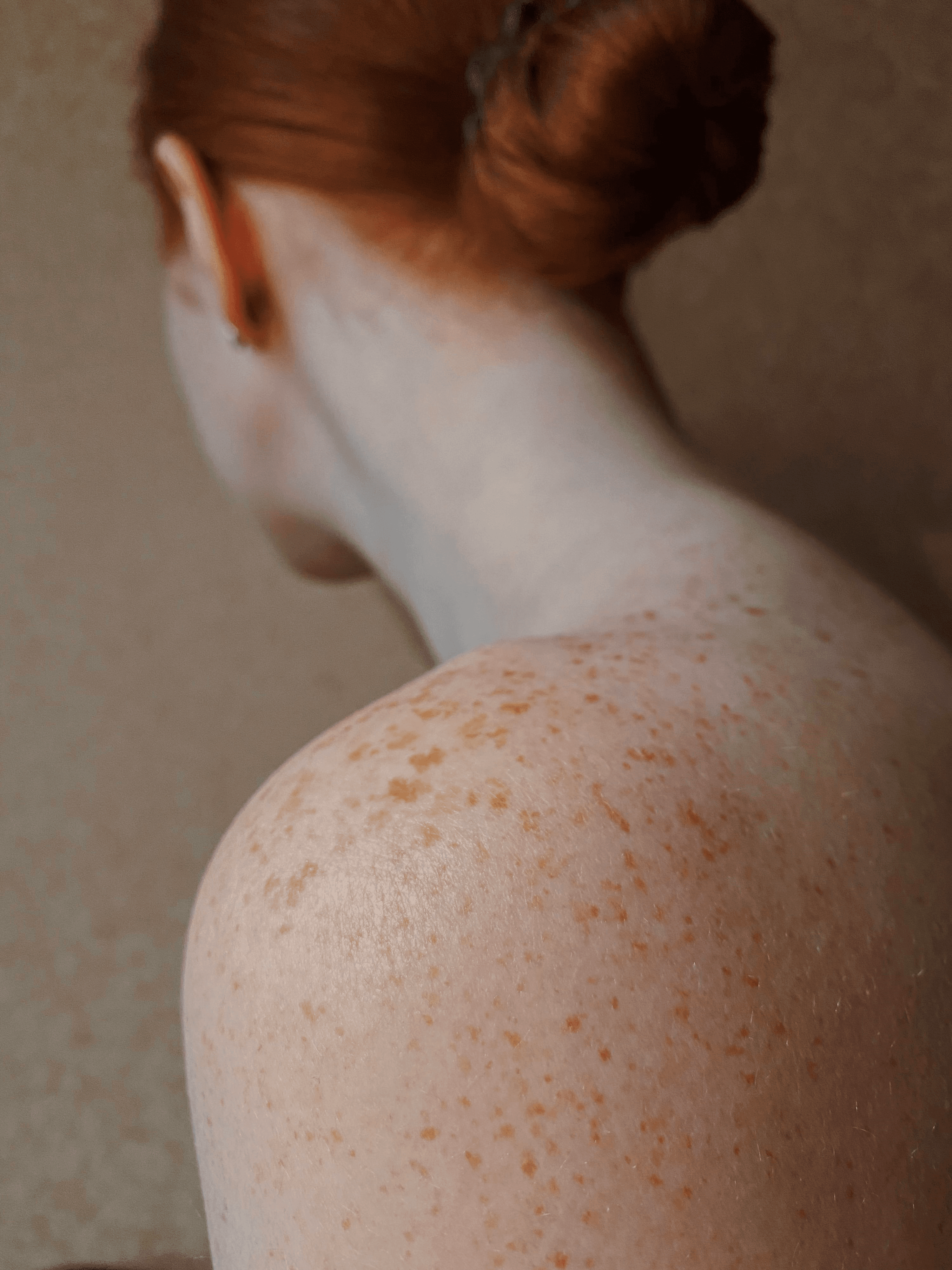 Skin Rashes - Image 2
